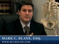 How Case Value is Determined?